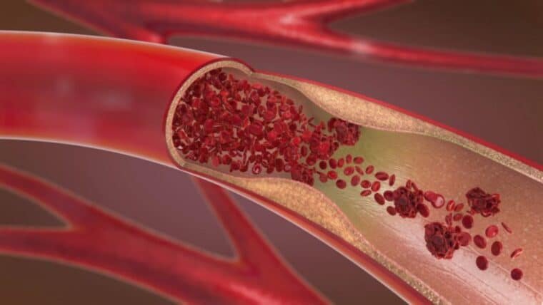 10 síntomas del cáncer que pueden pasar desapercibidos