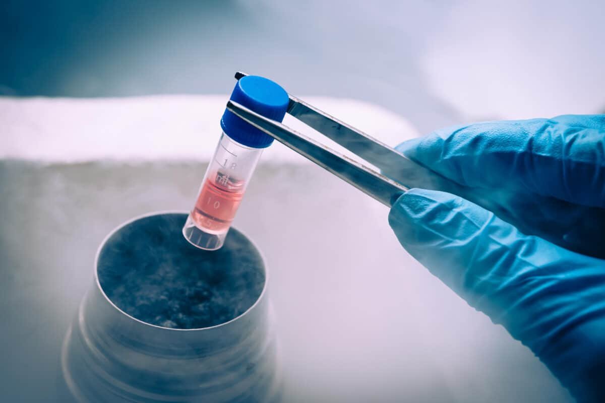 Científicos lograron revertir la diabetes con trasplante de células madre en una paciente