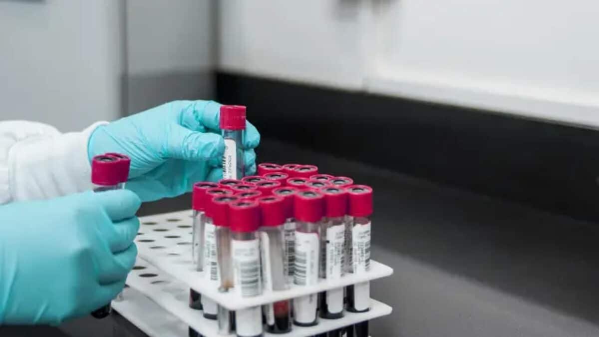 Día Mundial de la anemia: ¿cómo afecta la salud femenina y cuáles son sus indicadores?