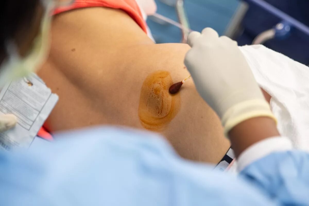 Un análisis de sangre podría reemplazar a las muestras en médula ósea para detectar leucemia
