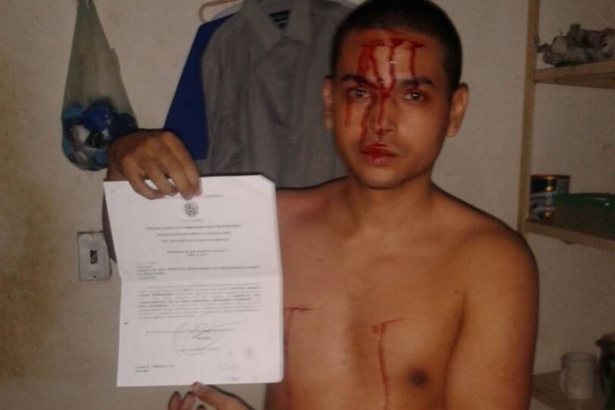 “Perdí el control de mi espíritu, me deshumanizaron”: el testimonio de Antony Vegas sobre su paso por El Helicoide